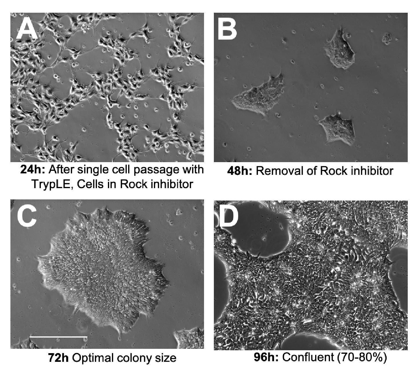 Typical 4 day iPSC culture. Cells grown on Laminin-521 in iPS-brew. Single cell passaging using TrypLE. Scale Bar = 200 μm