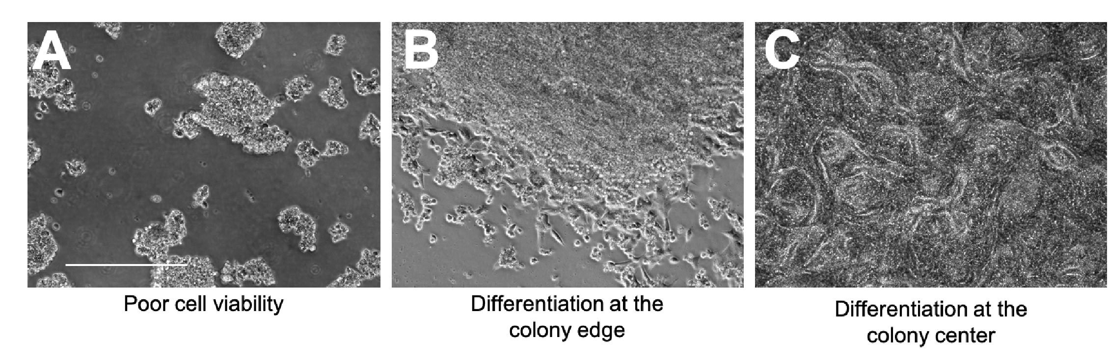 induced pluripotent stem cells Morphological signs of compromised viability and spontaneous differentiation. Scale bar = 200 μm