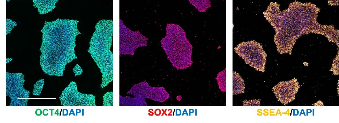 Example of pluripotency staining for OCT4, SOX2 and SSEA-4. Scale bar = 200 μm
