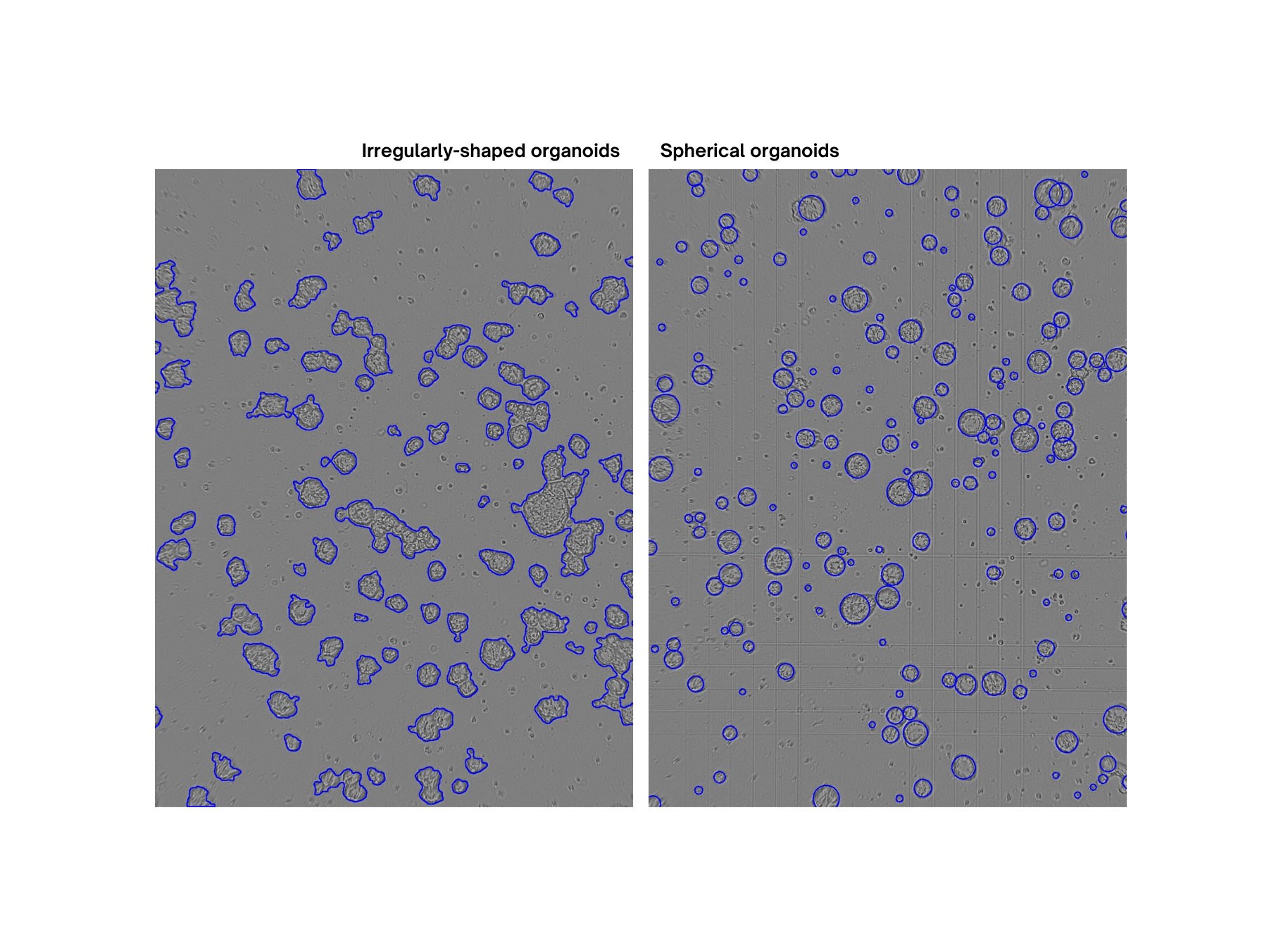 Irregular vs spherical organoids