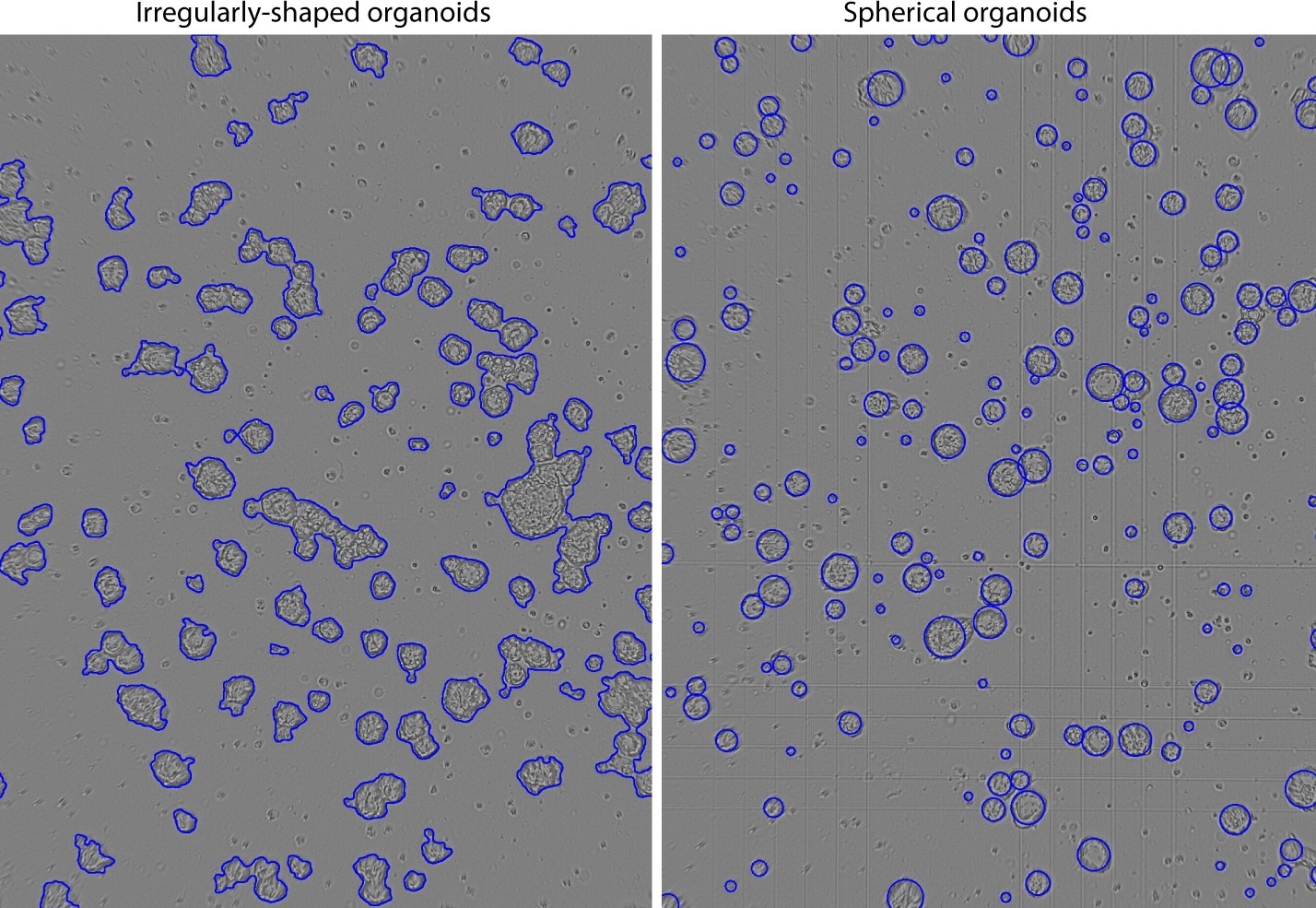 Organoid shape