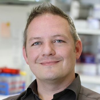 The CytoSMART Omni is ideal to perform kinetic assays to map cell proliferation, which we use as a tool to understand drug resistance in pancreatic cancer cell lines.