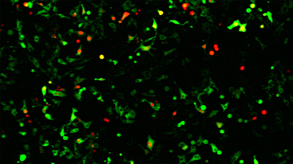 Transfection