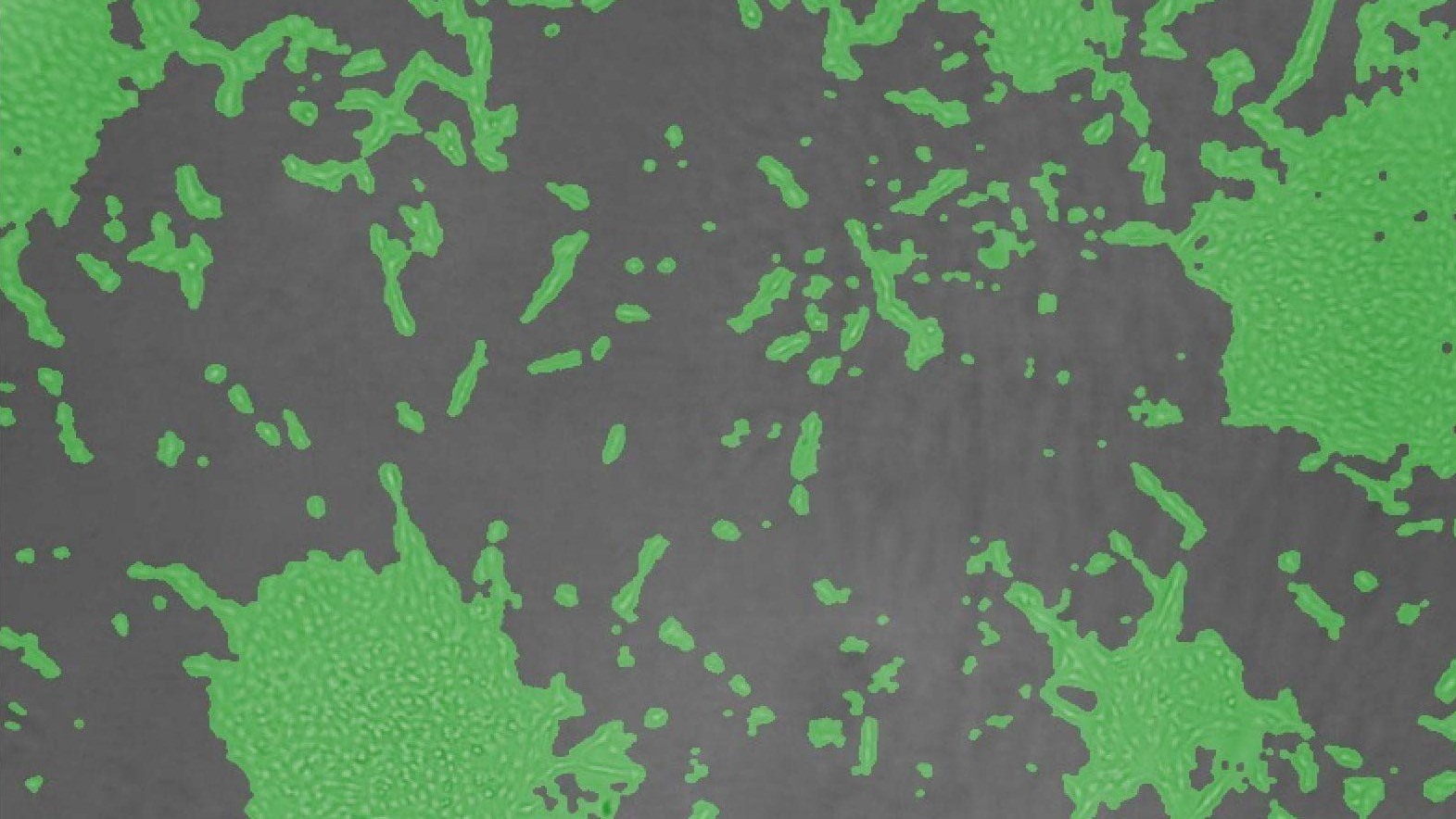 Cell Confluence