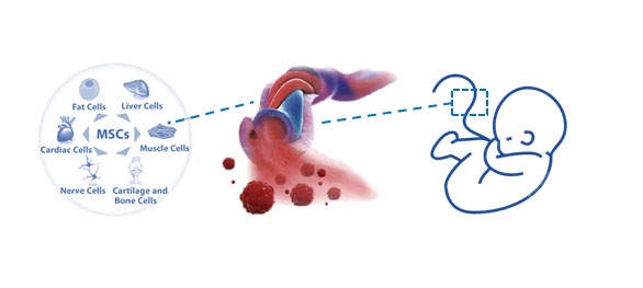 umbilical cord mesenchymal stem cells are a valuable stem cell source and can differentiate to adipose cells, hepatocytes, cardiocytes, muscle cells, nerve cells and cartilage and bone cells