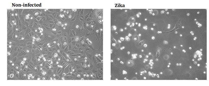 Vero cells were infected with Zika virus. After 72 h of infection, a clear CPE is evident by the presence of cell debri as a result of cell death.