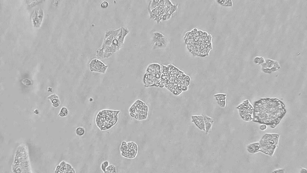 Snapshot colony 9 5h